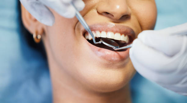 Best Emergency Dentist for Lost Fillings or Crowns in Chama, NM